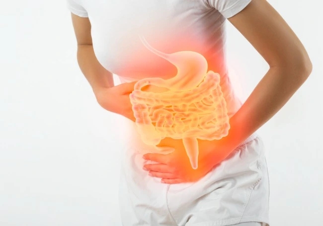 Abdomen agudo